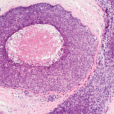 Oakstone CME Breast Pathology [2022] - CMEList