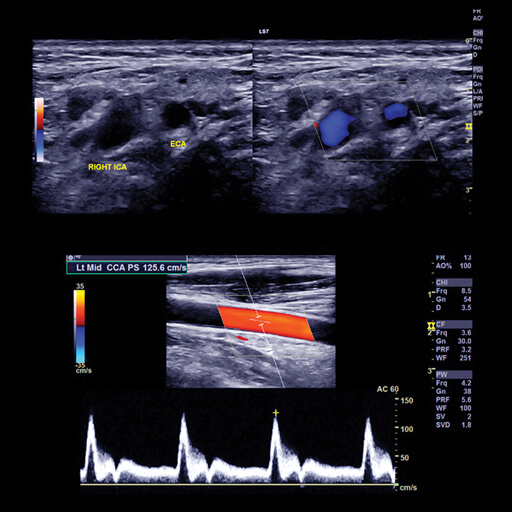 Oakstone Clinical Approach to Vascular Ultrasound and RPVI Prep Course ...