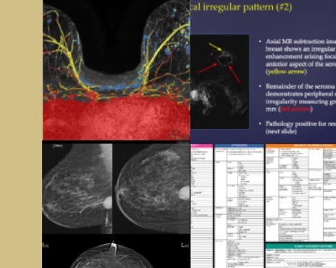 Efficiency Learning Systems CME Courses - Breast Imaging CME Hot Topics I